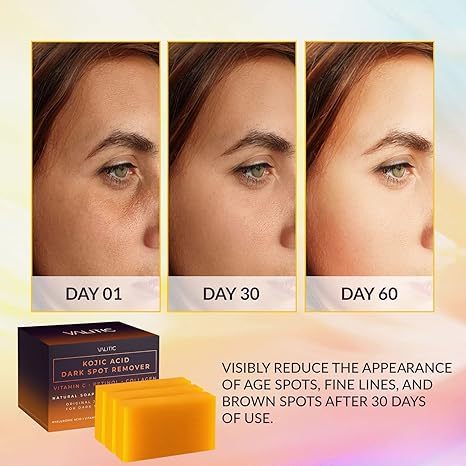 VALITIC Kojic Acid Dark Spot Remover Soap Bar
